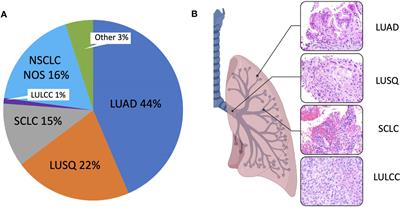 Lack of racial and ethnic diversity in lung cancer cell lines contributes to lung cancer health disparities